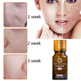 Before and after images showing scars of acne treatment progress over three weeks with essential oil bottle