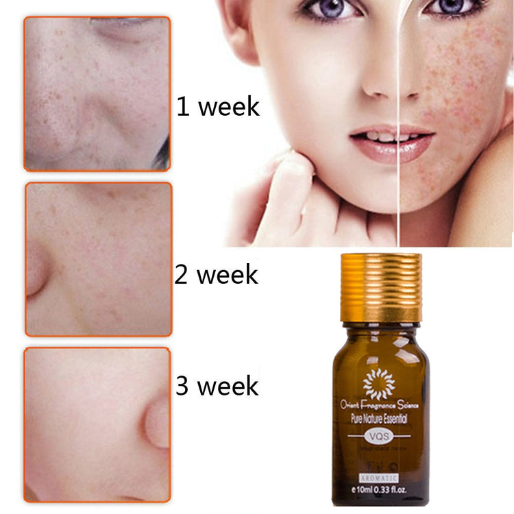 Before and after images showing scars of acne treatment progress over three weeks with essential oil bottle