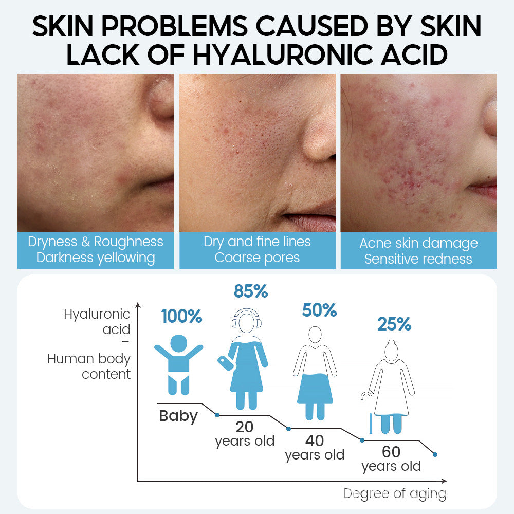 Infographic showing skin problems caused by lack of hyaluronic acid linked to dryness, fine lines, acne, and aging skin for organic and functional face mask