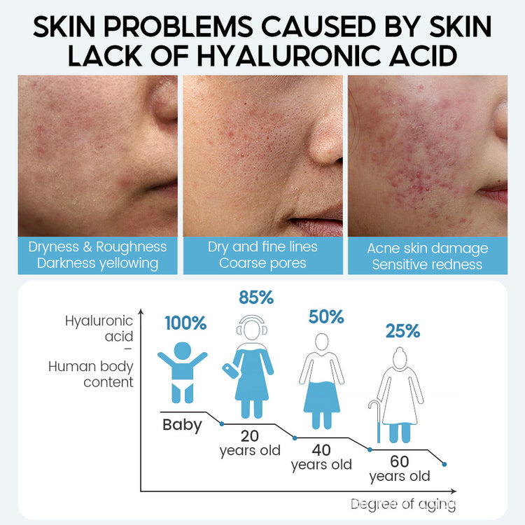 Infographic showing skin problems caused by lack of hyaluronic acid linked to dryness, fine lines, acne, and aging skin for organic and functional face mask
